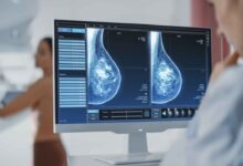 La IA reduce en un 12% los diagnósticos tardíos de cáncer de mama