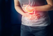 Médicos advierten sobre el peligro de los ayunos prolongados