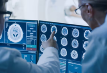 Científicos hallan una nueva vía genética para frenar el avance del Huntington