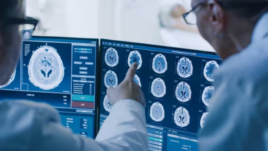 Científicos hallan una nueva vía genética para frenar el avance del Huntington