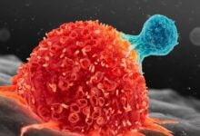 Científicos identifican los mecanismos celulares que impulsan el desarrollo del cáncer