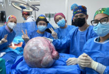Extraen tumor de más de 25 kilos en Anzoátegui