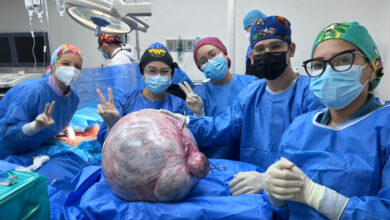Extraen tumor de más de 25 kilos en Anzoátegui
