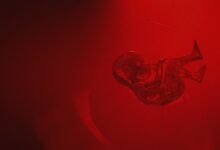 Crean máquina "Madre" capaz de mantener vivo un útero fuera del cuerpo