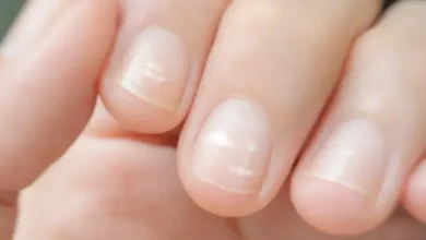 Por qué salen manchas blancas en las uñas y cómo eliminarlas