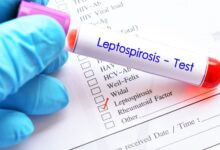 Brote de leptospirosis en Perú deja nueve muertos y 1.200 contagios