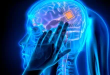 Prueban en humanos el primer implante cerebral contra la depresión