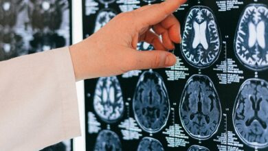 Vacuna contra la gripe de alta dosis reduciría el riesgo de Alzheimer en un 55%, según estudio