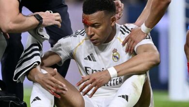 Kylian Mbappé no entrena tras recibir puntos en una ceja por un golpe