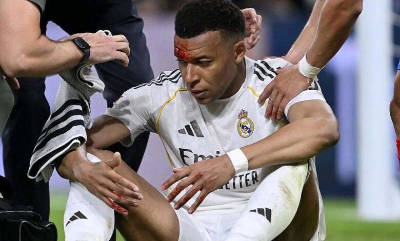 Kylian Mbappé no entrena tras recibir puntos en una ceja por un golpe