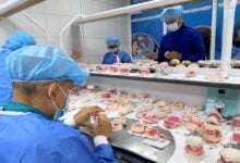 Misión Sonrisa ha beneficiado a más de 7 mil 500 pacientes