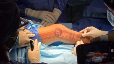 Realizan en el Humnt cirugía ortopédica que solo se hacía en Caracas