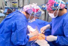 Hospital "Tulio López Ramírez" alcanza las 764 operaciones desde su rehabilitación