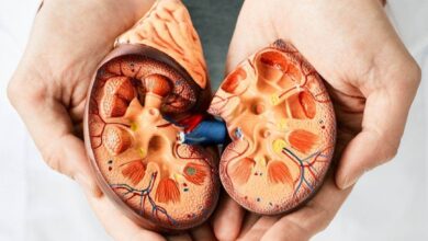 ¿Sufres de cálculos? Expertos advierten sobre las altas probabilidades de volver a padecerlos