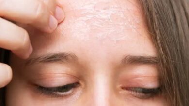 El Espejo del Alma: Por qué tu estrés se convierte en acné o psoriasis