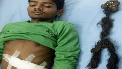 El misterio del dolor de estómago crónico de un joven que resultó ser su propio hermano