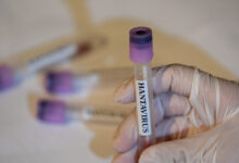 Francia confirma su primer caso positivo de hantavirus