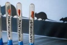 Mantienen bajo vigilancia a 41 personas por exposición al hantavirus en EE.UU.