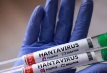 OMS: No existen vacunas ni tratamientos específicos contra el hantavirus