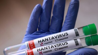OMS: No existen vacunas ni tratamientos específicos contra el hantavirus