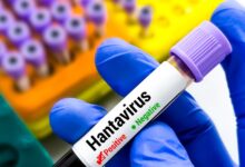 Hantavirus en Brasil: Estudio revela letalidad del 50 % en adolescentes de 15 a 19 años