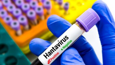 Hantavirus en Brasil: Estudio revela letalidad del 50 % en adolescentes de 15 a 19 años
