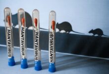 Diferencias entre el hantavirus y el COVID: Por qué no debemos entrar en pánico