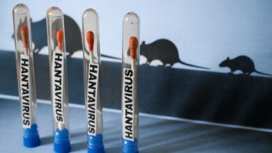 Diferencias entre el hantavirus y el COVID: Por qué no debemos entrar en pánico
