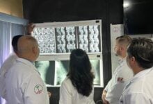 Monagas liderará el Plan Quirúrgico Nacional de Escoliosis