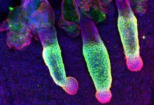 Descubren la proteína clave que mantiene encendido el "motor" del crecimiento del cabello
