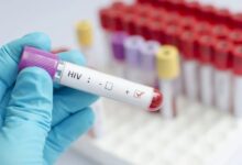 Investigan un brote de VIH en 78 niños por presunta negligencia médica en Pakistán
