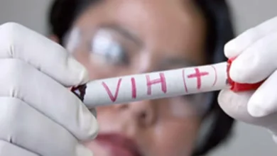 Advierten sobre el riesgo de un resurgimiento del VIH tras una caída del 18 % en la financiación mundial