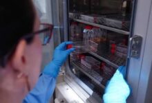 Científicos usan "tijeras moleculares" para eliminar el ADN del VIH con un 97 % de efectividad