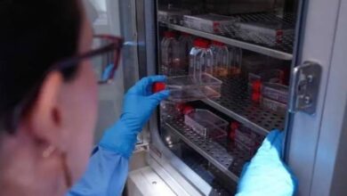 Científicos usan "tijeras moleculares" para eliminar el ADN del VIH con un 97 % de efectividad