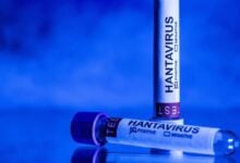Franco-argentino da positivo por hantavirus tras realizarse pruebas en Francia