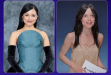 Especialistas alertan por el impacto del nuevo canon de delgadez en las celebridades