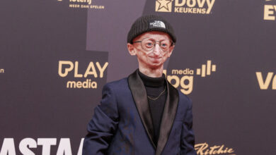 Fallece a los 28 años el creador de contenido belga Michiel Vandeweert, quien padecía progeria