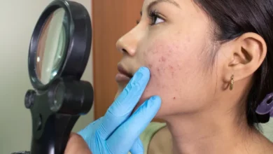 Sociedad dermatológica rechaza contenido de influencers sobre área de salud