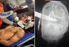 Adolescente apuñala a un joven en la cabeza por una deuda en La Guaira