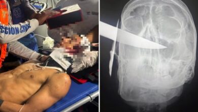 Adolescente apuñala a un joven en la cabeza por una deuda en La Guaira