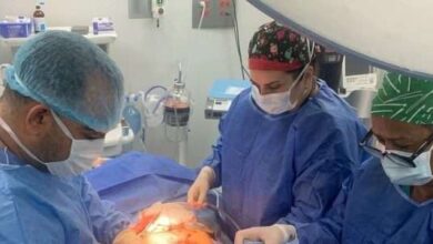 Extirpan un tumor ovárico de 70 centímetros a una paciente en La Guaira