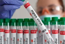 Bebé de 21 días se convierte en la tercera víctima mortal por Mpox en Angola