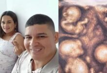 Nacen cuatro bebés idénticos en Medellín: un hito médico en Colombia